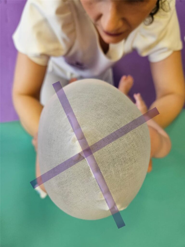 Fisioterapeuta avaliando a assimetria craniana de um bebê durante atendimento na AmarElo